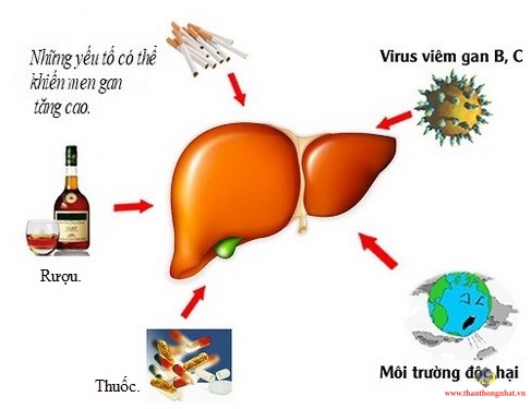 Uống nhiều rượu, mắc viêm gan b, C, hút thuốc, môi trường độc hại, sử dụng quá nhiều thuốc… là những nguyên nhân gây tăng men gan.